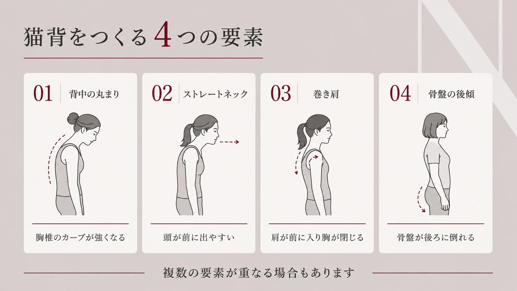猫背をつくる背中の丸まり・ストレートネック・巻き肩・骨盤後傾の4つの要素